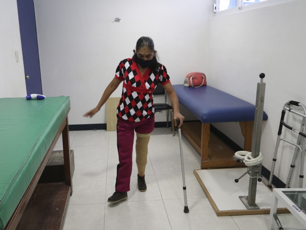 Beneficia SEDIF a persona de Tlacuilotepec con una prótesis